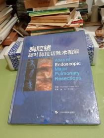 胸腔镜肺叶肺段切除术图解【未拆塑封】