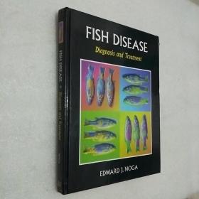 FSH DISEASE  DIAGNOSIS DND TREATMENT