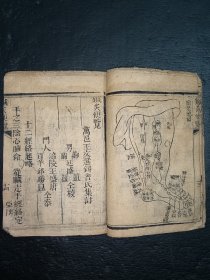 清中医《针灸便览》一册全。内包含祝由十三科。古籍是古人思想的宝藏、先贤智慧的结晶，古籍关注度的提升，对历史有重要了解的意义。品如图，前后完整不缺页，具体如图。