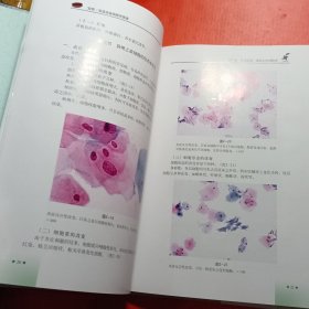 宫颈、阴道液基细胞学图谱