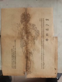 针灸图四张。