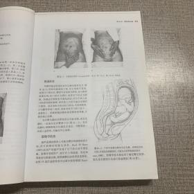 世界权威医学著作译丛  威廉姆斯产科学 21版（中 下）缺上