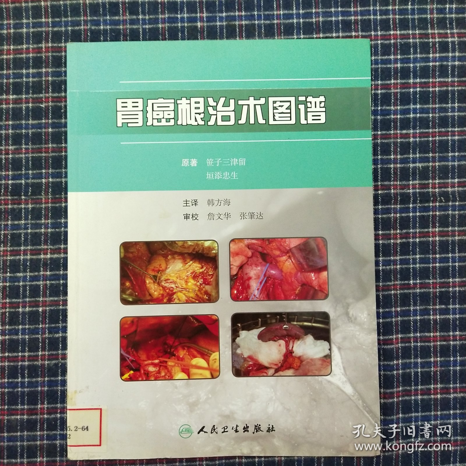 胃癌根治术图谱