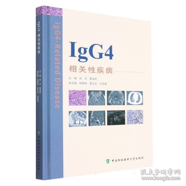 IgG4相关性疾病