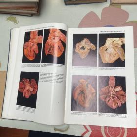 Atlas der pathologischen Anatomie病理解剖图谱(品自鉴）