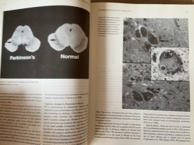 【英文原版】Memory in Neurodegenerative Disease 神经退行性疾病中的记忆
