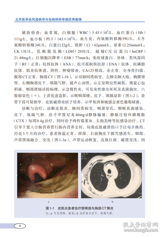 北京医学会风湿病学分会病例串串烧优秀集锦