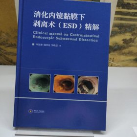 消化内镜黏膜下剥离术(ESD)精解