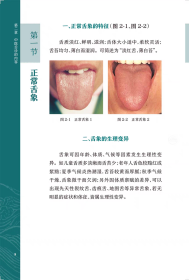 中医舌诊图谱