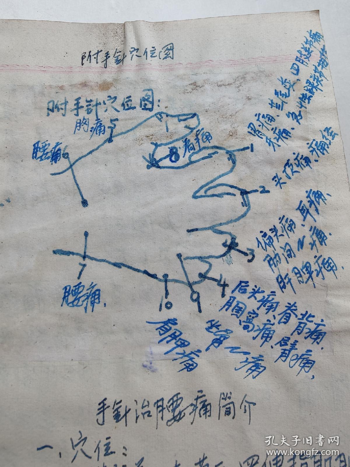 中医文献《工作与学习笔记》水针疗法，手针疗法，新针治疗常见疾病，穴位刺激疗法，小儿单纯消化不良划疗法，割治的方法，(图文并茂) 主治支气管炎，喘息，头顶痛，痛经，臂痛，胸痛，腰痛，肩胛痛，手针治腰痛，治疗痔疮  内痔，外痔，肛门骚痒，轻度股肛，腿细无力，发凉能走，腿软弱无力，上肢细无力尚能活动，但手握力小，上肢抬举困难，肘部屈伸困难. 手腕不能伸展，上肢完全瘫软，如面条发凉，肌肉严重萎缩！