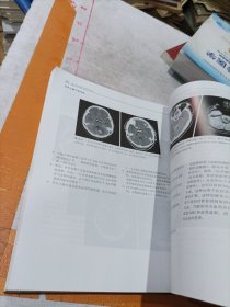 脑卒中神经影像学实例解析