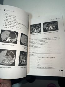 CT和MRI阅片原则与报告书写规范（内有少许笔记划线）