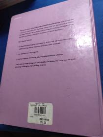 handbook of clinical audiology 临床听力学手册