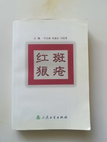 红斑狼疮