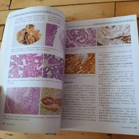 乳腺及女性生殖器官肿瘤病理学和遗传学 -内页有铅笔笔迹