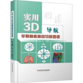 实用3D导航早期肺癌肺段切除图谱