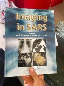 Imaging in SARS[非典的醫(yī)學(xué)成像]
