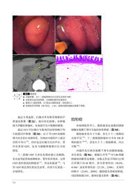 胃与肠：希望大家了解的十二指肠病变