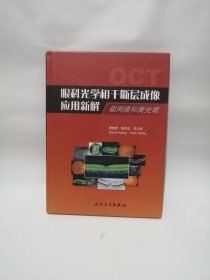 眼科光学相干断层成像应用新解：视网膜和青光眼