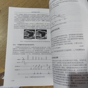 医学成像技术原理