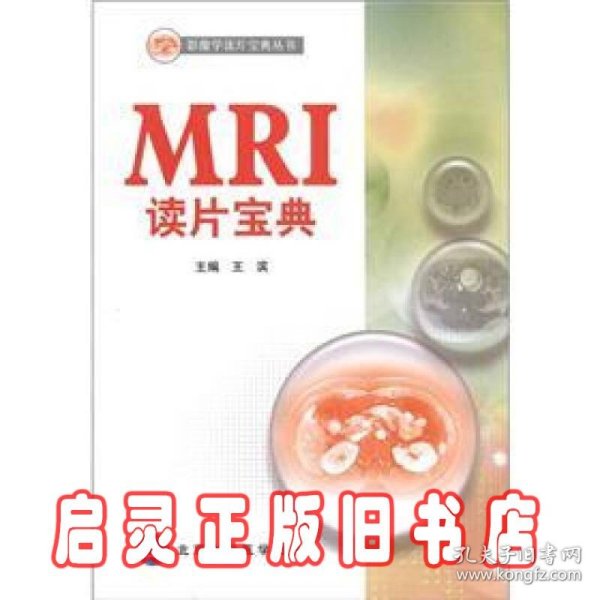 影像学读片宝典丛书：MRI读片宝典