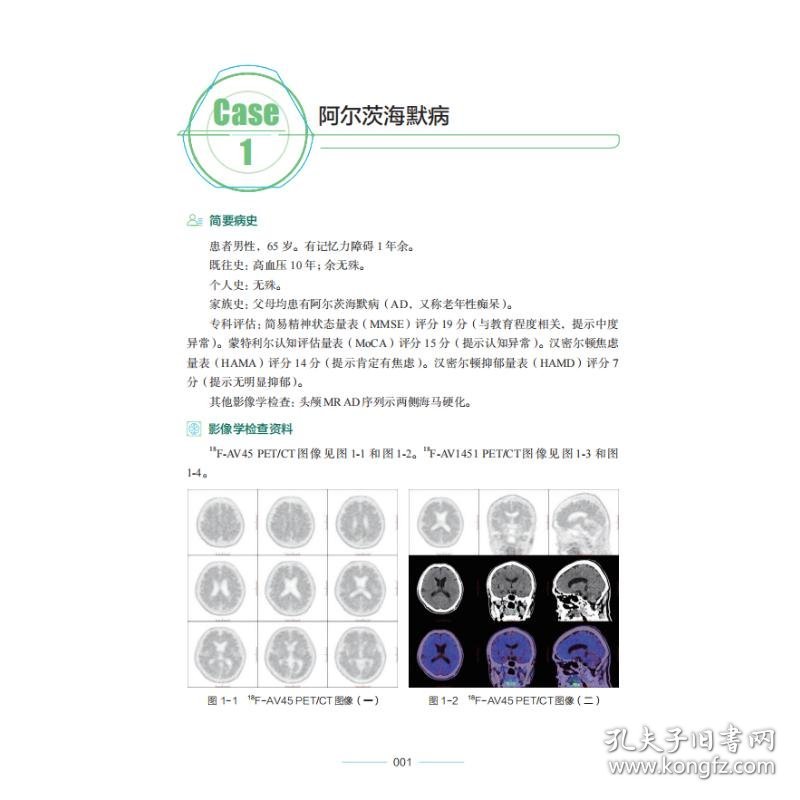 PET/CT与PET/MR疑难病例集萃