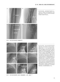 【全新正版，假一罚四】冠心病介入治疗解码9787117326568黄浙勇，葛均波