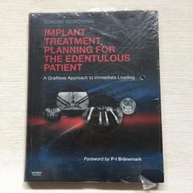 Implant Treatment Planning for the Edentulous Patient