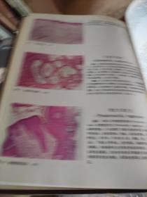 皮肤组织病理彩色图谱（16开精装本）全彩精印 82年1版1印