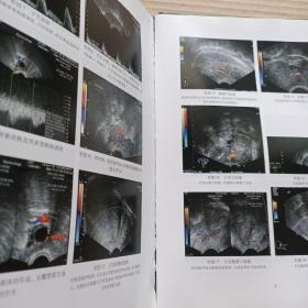 经阴道超声诊断学（第二版）特价