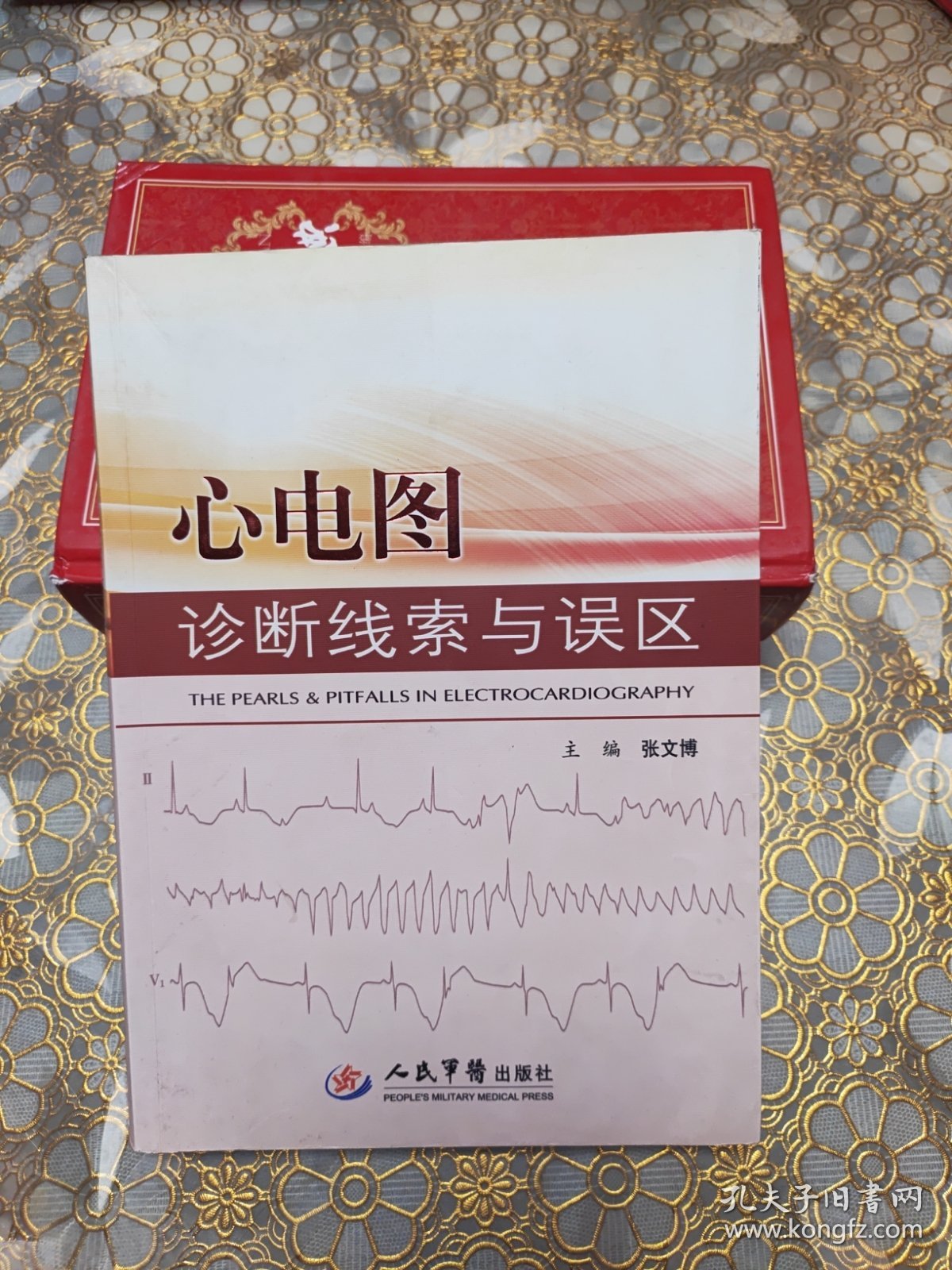 心电图诊断线索与误区