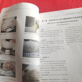 人乳头瘤病毒感染防治 派特灵、伊可尔应用技术 第八版
