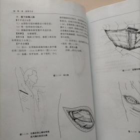 骨科手术图谱：上肢 下肢 脊柱（三册合售）