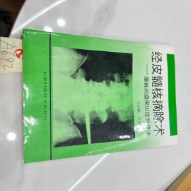 经皮髓核摘除术 腰椎间盘突出症新疗法