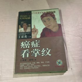 癌症看掌纹