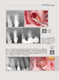 牙髓显微外科治疗技术 （意）阿纳尔多·卡斯泰卢奇（Arnaldo Castellucci）主编 阙克华，屈铁军主译 正版图书