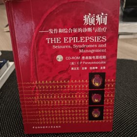 癫痫：发作和综合征的诊断与治疗