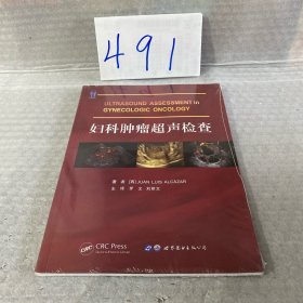 妇科肿瘤超声检查