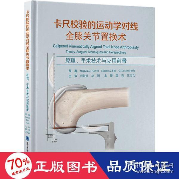 卡尺校验的运动学对线全膝关节置换术——原理、手术技术与应用前景