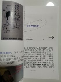 《十四种病症实用针灸精选》