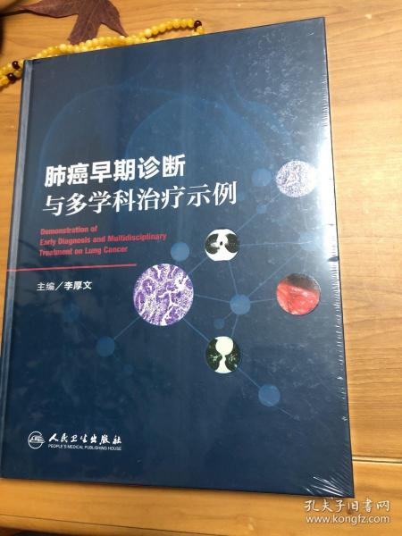 肺癌早期诊断与多学科治疗示例