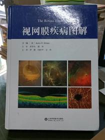 视网膜疾病图解   (精)