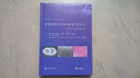 肿瘤重度免疫治疗相关不良反应——病例集萃及管理共识