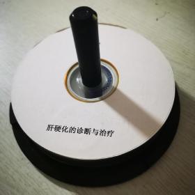 肝硬化的诊断与治疗VCD