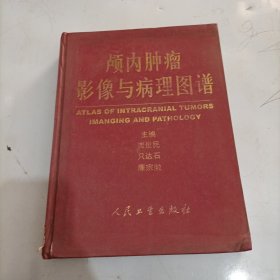 颅内肿瘤影像与病理图谱