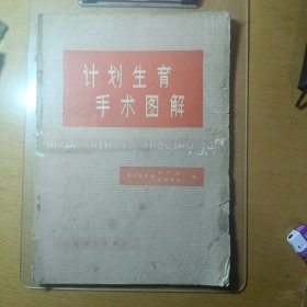 计划生育手术图解