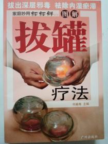 拔罐疗法