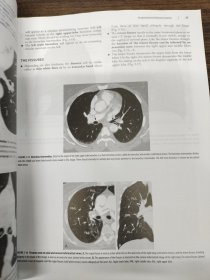 影像诊断学基础教程（第3版）（影印）