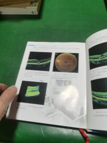 协和眼科光学相干断层扫描（OCT）图谱