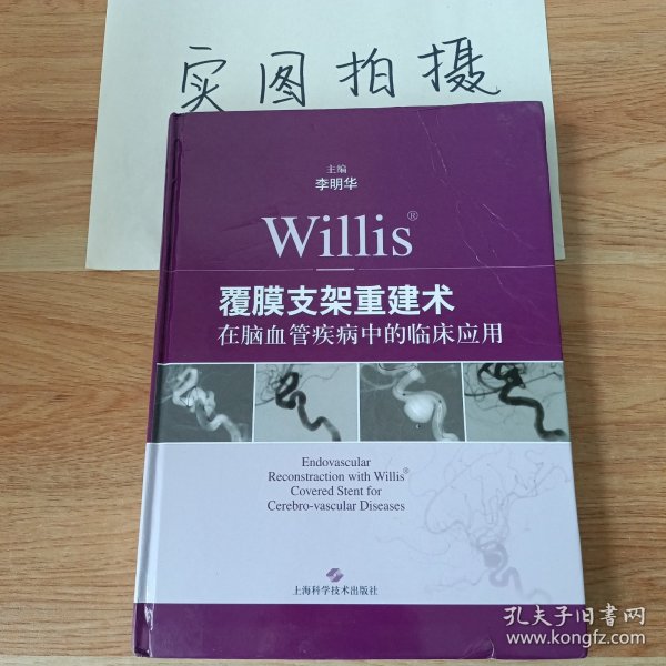 Willis覆膜支架重建术在脑血管疾病中的临床应用